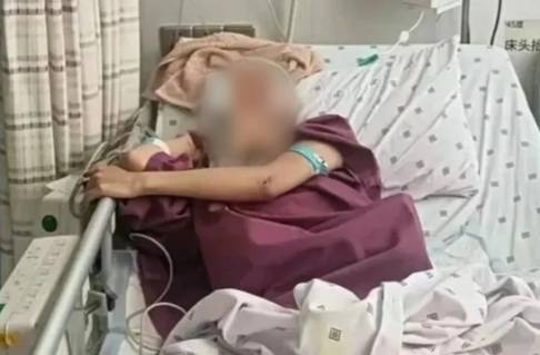중국 동부의 한 20세 여성이 남자친구와 심한 말다툼 후 18층 아파트에서 뛰어내렸지만 기적적으로 살아남았다. [사진출처 = SCMP]