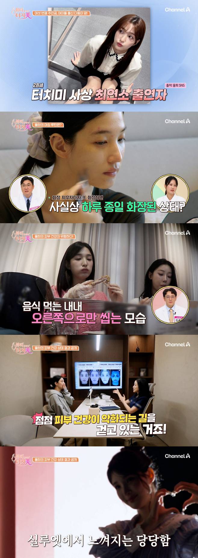 ‘뷰티 클리닉 터치미’ 율희, 출산 후 무너진 피부 상태 공개 (제공: 채널 A)