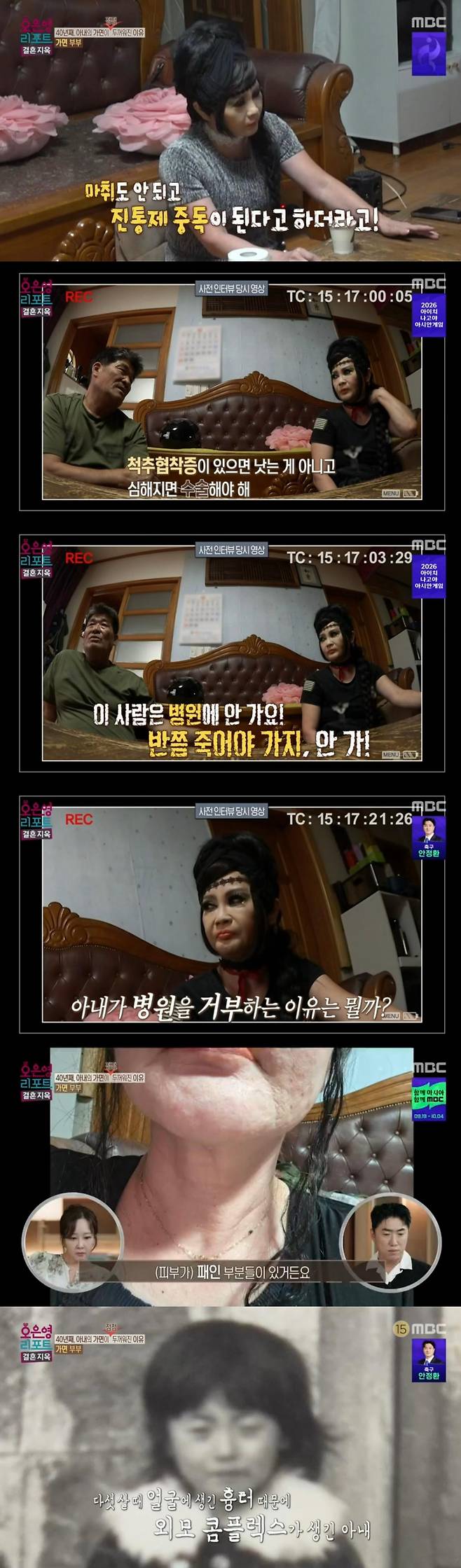 출처:MBC '오은영 리포트-결혼 지옥'