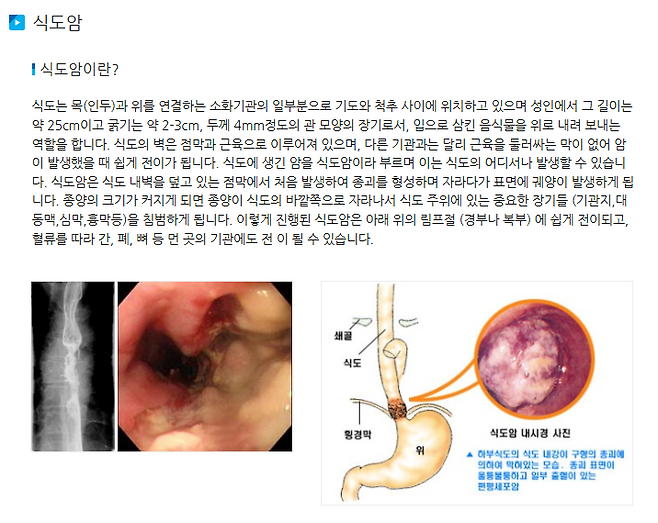 자료출처-서울대 병원