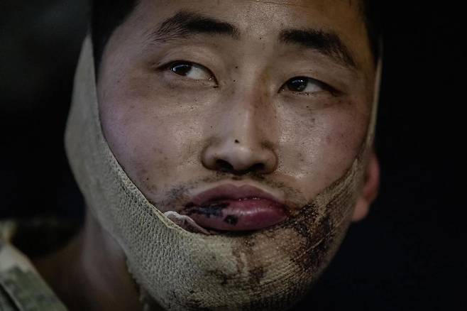 볼로디미르 젤렌스키 우크라이나 대통령이 X를 공개했던 북한군 포로 사진. /X
