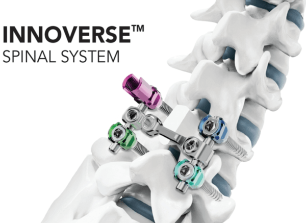 시지메드텍의 척추 고정 장치 '이노버스 스파이널 시스템(INNOVERSE Spinal System)'. [출처=시지메드텍]