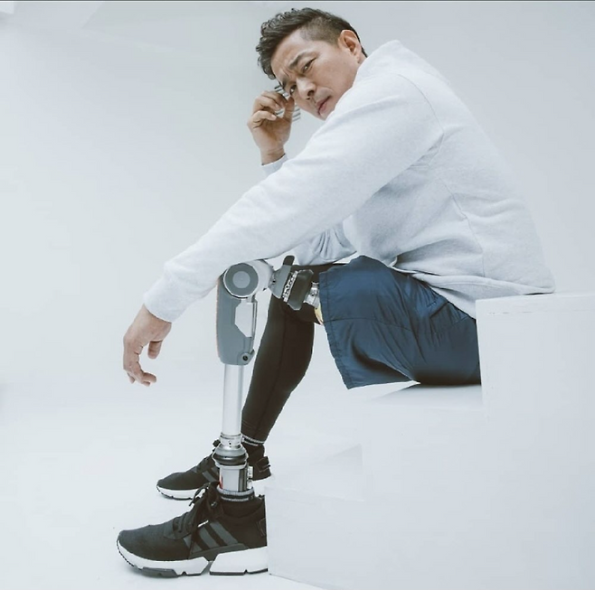 떳떳하게 의족을 드러낸 한민수 스포츠윤리센터 이사장 직무대행. 한민수 제공