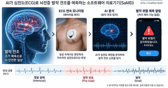 뇌전증 치료기 SaMD의 작동 원리를 설명하는 시각 자료. /오션스바이오