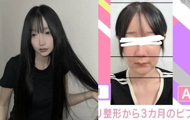 최근 한국에서 양악수술, 안면윤곽수술 등을 받았다고 고백한 일본 방송인 타다(33)씨. 사진=아베마 타임스, 뉴시스