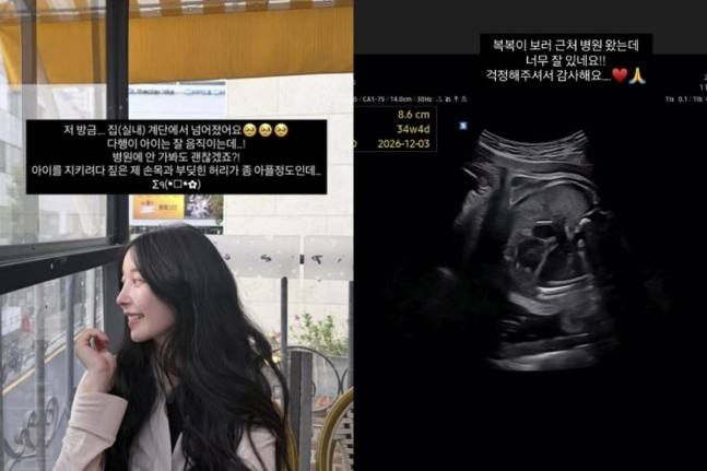 아야네 소셜미디어
