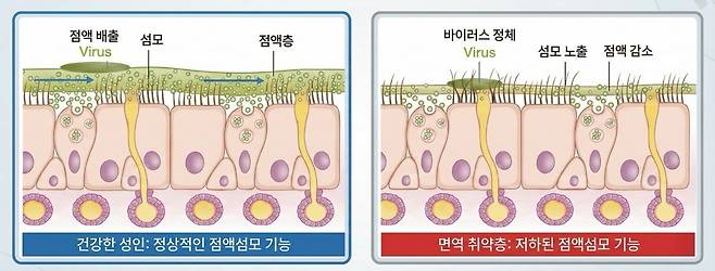 코 점막의 점액섬모 운동 원리｜출처: 하이닥