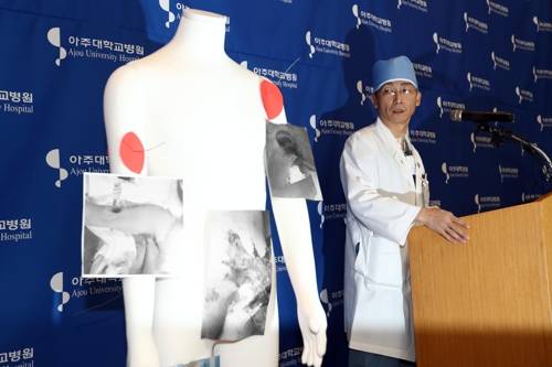 지난 15일 아주대병원에서 이국종 교수가 총상을 입은 채 귀순한 북한군 병사의 수술결과 및 환자 상태에 대해 브리핑을 하는 모습. 이날 병사의 기생충 감영 내용에 대해 밝혔다.