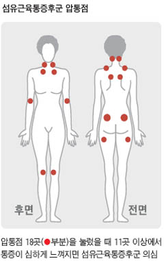 섬유근육통이 의심될 때는 붉게 표시된 부분의 압통점 18곳을 눌러보자. 이때 11곳이 심하게 아프다면, 섬유근육통일 확률이 높다. 사진-헬스조선DB