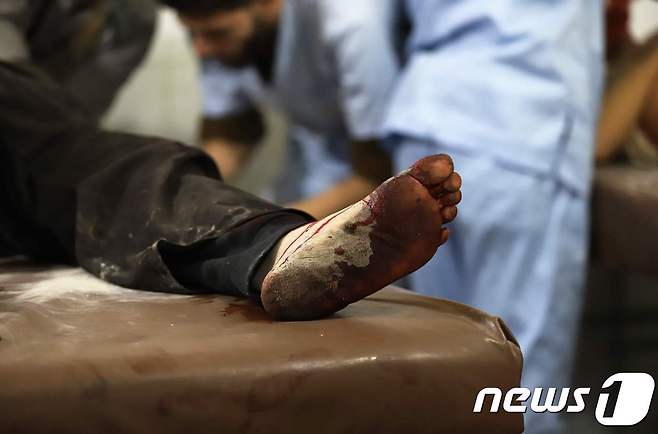 21일(현지시간) 시리아 정부군의 공습이 이어지는 동구타의 한 병원 모습. © AFP=뉴스1