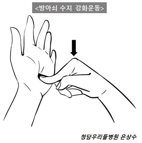 방아쇠 수지 근력 강화 운동 /사진-은상수 전문의 제공