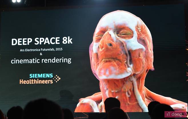 인체 내부를 고화질 VR로 확인할 수 있는 '딥 스페이스 8K'