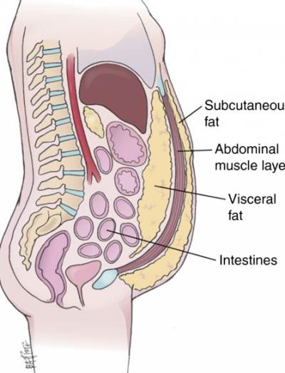 복근(abdominal muscle layer)과 피부 사이에 피하지방(subcutaneous fat)이, 복근과 장(intestines) 사이에 내장지방(visceral fat)이 존재한다. 복부비만 정도가 비슷해도 개인에 따라 둘의 비율이 꽤 다를 수 있고 나이가 들수록 내장지방의 비율이 높아진다. - Health Assessment in Nursing 제공 )