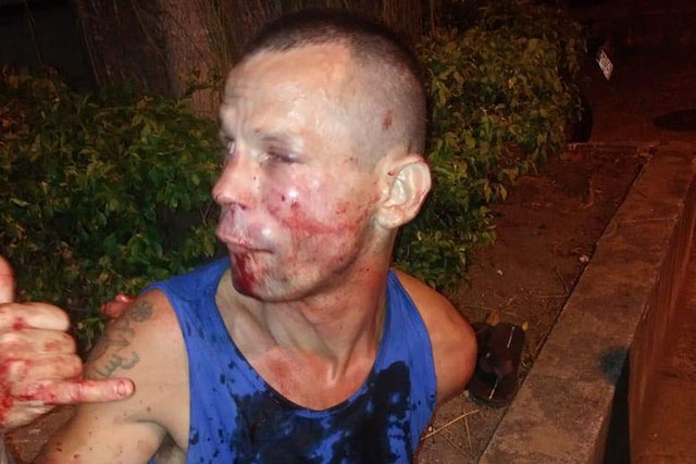 ▲ UFC 여성 파이터를 위협했다가 봉변을 당한 강도의 최후. 얼굴이 퉁퉁 부었다.
