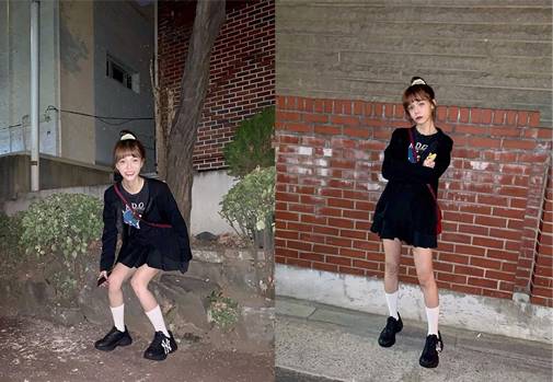 ▲ '다이어트는 이제 그만'…걱정 되는 최근 모습