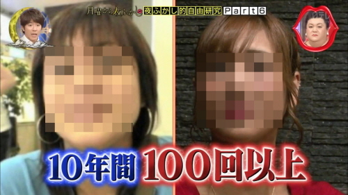 10년간 100회 넘는 성형수술로 화제가 된 일본여성. 사진= NTV 방송화면 캡처