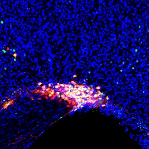 전신마취 상태에서 활성화한 시삭상핵 뉴런(붉은색 부분) [듀크대 제공]