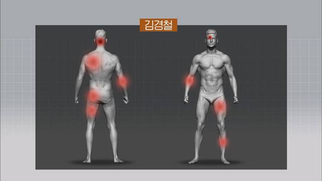 전신 타박상 입고 사망한 농아 청년 김경철 씨 사망 부위