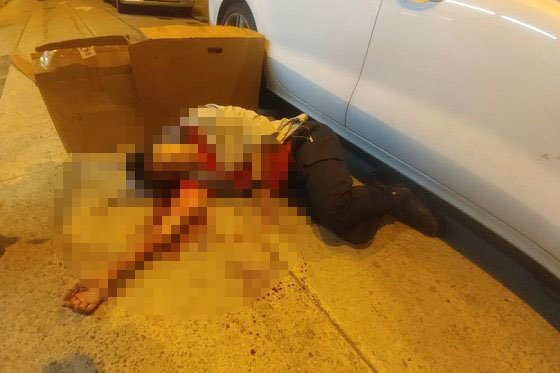 지미 샴 민간인권전선 의장이 16일 오후 괴한에게 쇠망치 습격을 받은 직후 길에 피를 흘리며 쓰러져 있는 모습.[AP=연합뉴스]