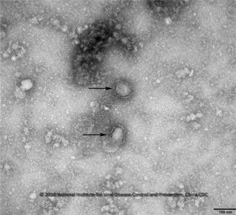 중국 우한 코로나바이러스 전자현미경 사진(사진=China CDC 제공)