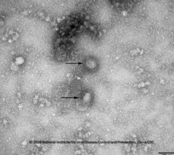 중국 우한 코로나바이러스 전자현미경 사진. 질병관리본부