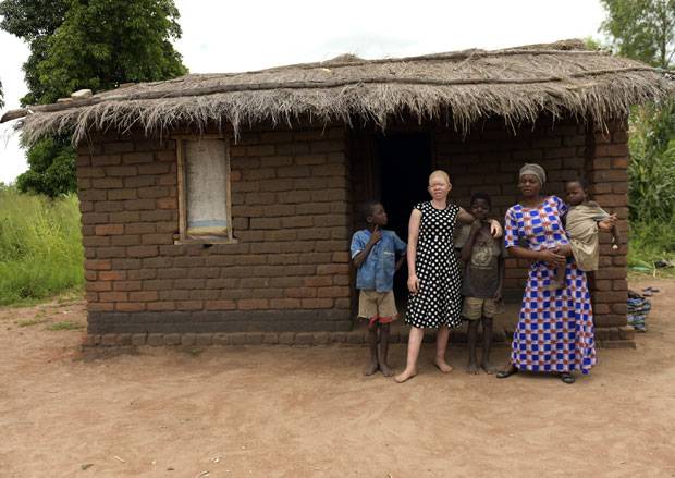 사진=AP 연합뉴스