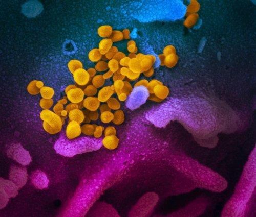 신종 코로나바이러스의 전자 현미경 영상 [미 NIH 국립 알레르기 감염병 연구소 제공. 재판매 및 DB 금지]