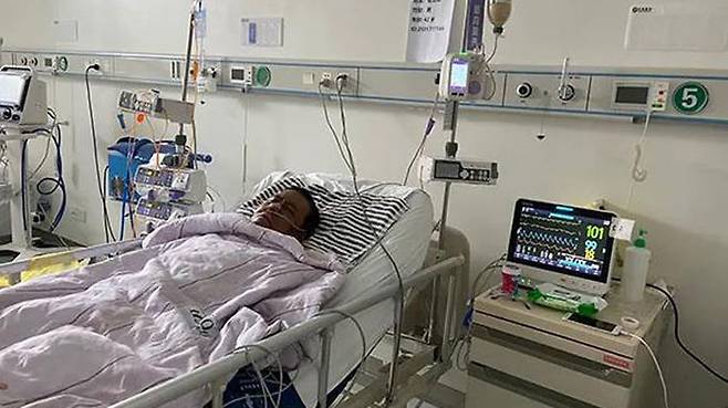 코로나19로 얼굴 검게 변한 중국 의사 투병 끝에 숨져 (사진=펑파이 캡처, 연합뉴스)