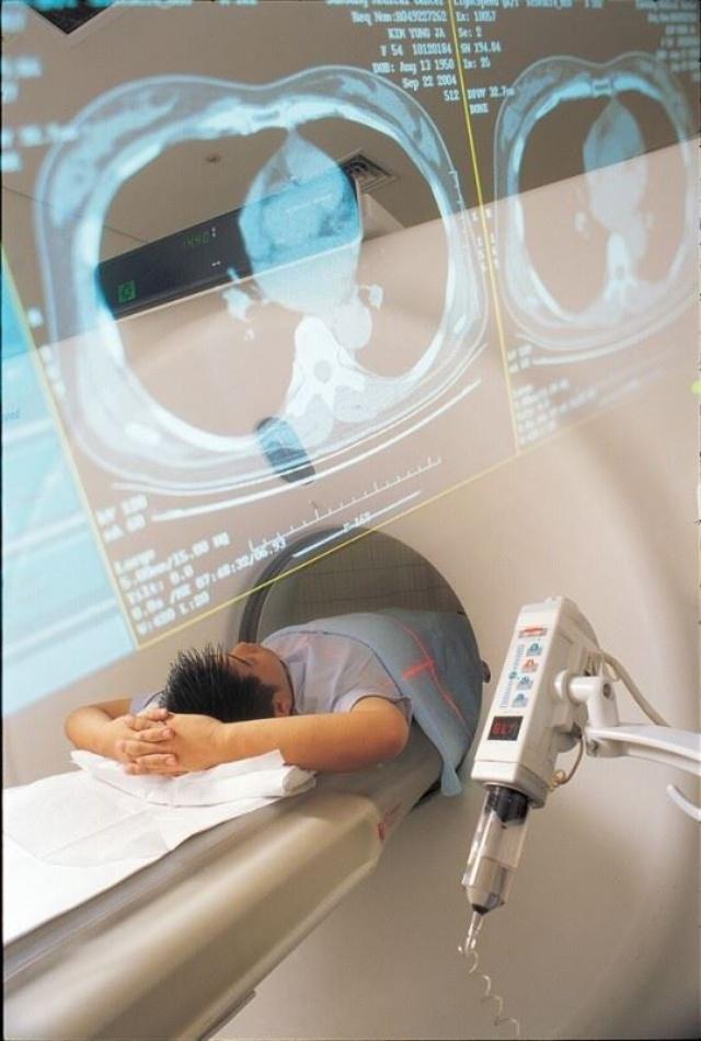 한 환자가 폐암 여부를 확인하기 위해 이미저선량 흉부 컴퓨터단층촬영(CT) 검사를 진행하고 있다. 한국일보 자료사진