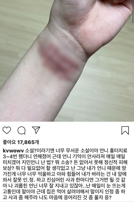 권민아 인스타그램 캡처