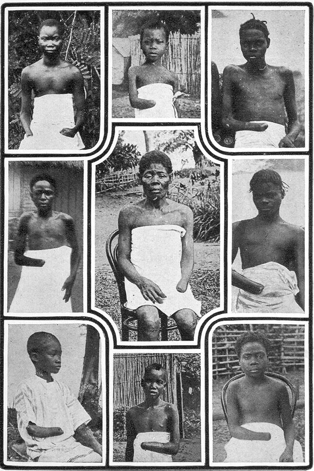 손이 잘린 콩고 자유국 원주민들. 레오폴 2세 식민 지배 당시 고무 수확 할당량을 채우지 못할 경우 신체를 훼손하는 등의 학대가 이뤄졌다. 위키피디아 갈무리.