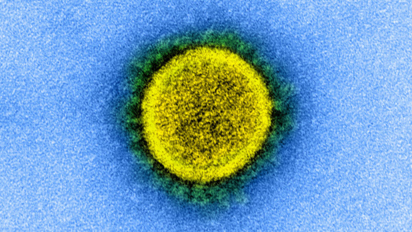 코로나바이러스의 전자현미경 사진. 표면의 돌기(스파이크)를 인체 세포에 결합시켜 침투한 다음 유전물질인 RNA를 복제한다./NIAID