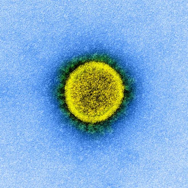 코로나19를 일으키는 사스코로나바이러스-2(SARS-CoV-2)의 현미경 사진이다. NIAID 제공
