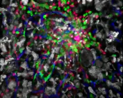 면역세포 공격 대식세포(녹색)와 CD8+ T세포의 공격을 받는 생쥐 췌장의 랑게르한스섬(회색). 청색은 혈관이다.  [스웨덴 웁살라대 Gustaf Christofferson 박사 제공 / 재판매 및 DB 금지]