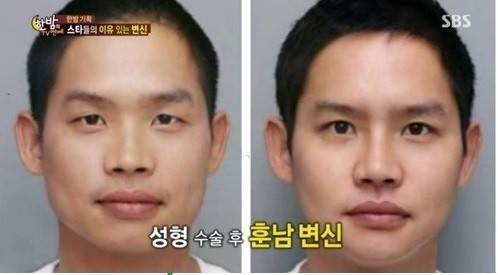 개그맨 김형인이 화제다.사진=SBS ‘한밤의 TV연예’ 방송캡처