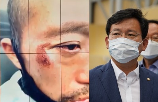 좌측은 폭행 피해자 모습(MBC 뉴스 화면 캡처) 우측은 김형동 국민의힘 의원 모습(페이스북 캡처)