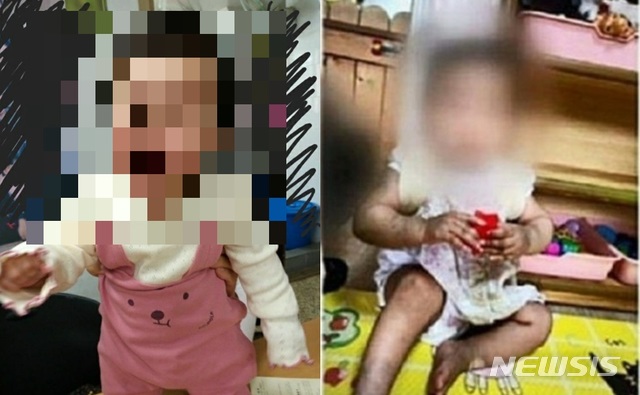 [서울=뉴시스] =서울 양천구에서 생후 16개월 여아가 사망한 사건과 관련해 아이가 입양가정에 보내지기 전(왼쪽)과 후에 극명하게 달라진 모습이 담긴 사진이 공개 됐다. 2020.11.17.