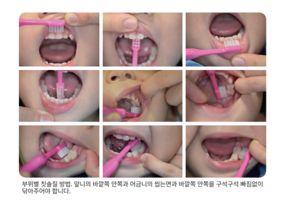 올바른 양치법/ 사진= 대한소아치과학회