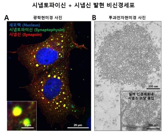 시냅토파이신과 시냅신에 의한 액체-액체 상분리 현상(오른쪽)과  비신경세포에서의 시냅스소낭 응집 모사 구조 형성. [한국연구재단]