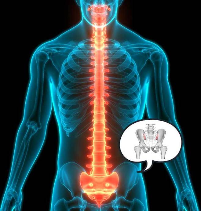 엉덩이와 척추 사이 위치한 ‘천장관절’에선 통증이 흔히 발생한다. 문제는 이 통증이 척추 신경의 문제인지, 관절 문제인지 가려내기 어렵다는 점이다. 통증의 원인을 찾고 그에 맞는 치료법을 적용해야 한다. /게티이미지뱅크 안강병원 제공