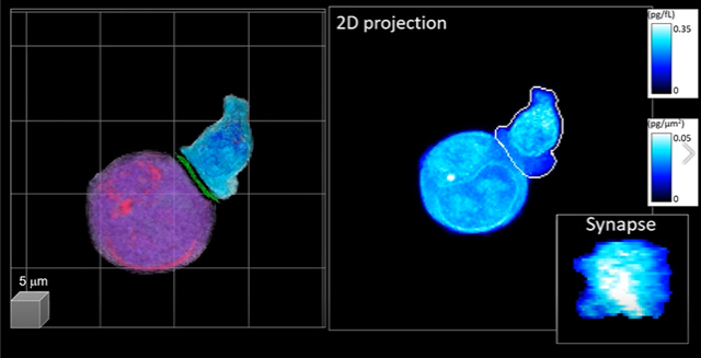 신기술을 이용해 표적 암세포(보라색)와 CAR-T 세포(파란색)의 모습을 관찰한 모습./사진=카이스트 제공