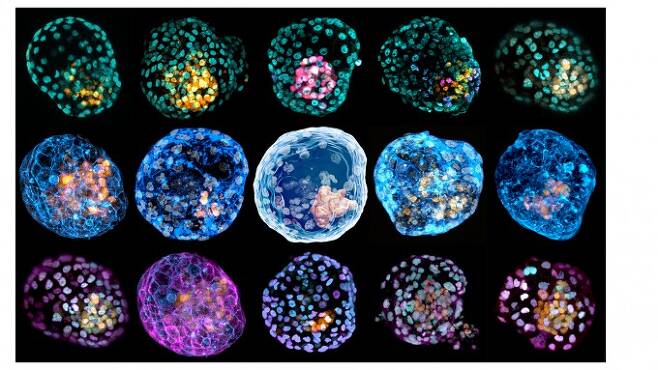 호주 모나시대 연구팀이 사람의 피부세포를 이용해 만든 배반포의 모습이다. 배반포는 수정란이 분열하며 만들어진 50~100개 세포가 둥그렇게 만들어진 조직으로 자궁에 착상하기 전 단계에 해당한다. 모나시대 제공