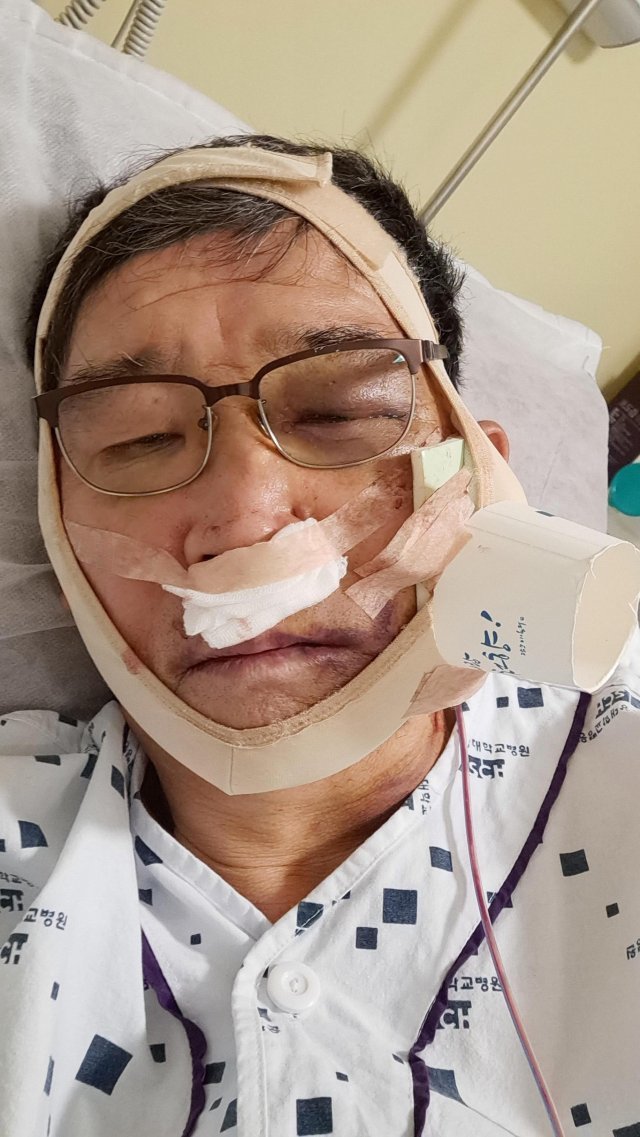 조성복 씨가 지난해 11월 11일 자전거 사고를 당한 뒤 병원에 누워 있는 모습. 조성복 씨 제공.