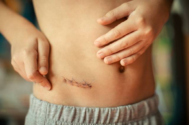 상처의 종류에 따라 사용할 수 있는 습윤드레싱의 종류가 달라진다. /사진=게티이미지뱅크