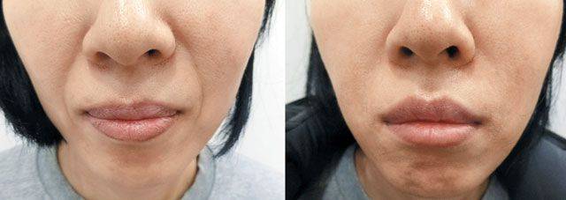 진성형외과 제공