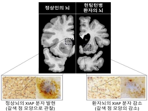 정상뇌의 XIAP 분자 발현(왼쪽)과 환자뇌 XIAP 분자 감소(오른쪽) [KIST 제공. 재판매 및 DB 금지]