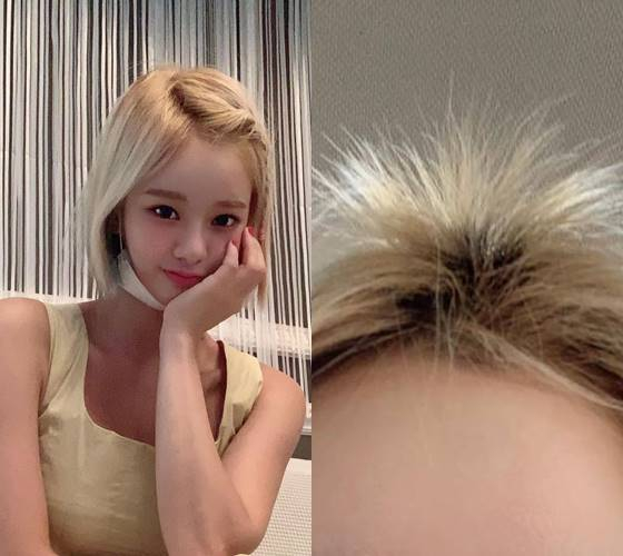 Maeng Seung-ji said on the 17th Instagram, I bleached at an Ilsan large shop last April, and the designer Sam left the hair for a long time and broke it.In the photo, Maeng Seung-ji was found to have been ripped off by a hair discoloration procedure in Salon.He said, In fact, it is so Gollum that it does not only broadcast or perform, but also interferes with everyday life.I bought a few Wigs, but when I performed, it was so unnatural and there were many scenes of running, so I could not stand Wig and I was forced to stick to it. (In June), I really put my head on Careful Careful. Maeng Seung-ji said, I felt like I was 90 years old Grandmas Boy because my head was gone!About 45% of the hair is torn off and it will take about a year and a half to two years to recover. Maeng Seung-ji also posted an infuriating note on the Instagram story, I do not want these people to really do beauty, I am so upset every time I see it, Why did you put nutrition if you do this, I touched my head, but I broke my head, and My head is poor.Its actually too much of a gollumas well as broadcasting and performing,Its been a distraction to my daily life.I bought some Wigs,Its just too unnatural for a performance,Theres a lot of running scenes, so we cant get Wig,Hanging on and holding on, I was forced to (in June)I really put my head on Careful Careful a littleI was active!Im gonna have to take my head offI really put on Careful and worked on Careful!Im losing my headIm not the same personI felt it!About 45% of the hair is torn offIf you want to go out and get it backIts gonna take a year and a half to two years.Im not gonna be able to do a year with bangs like I used toIm so sorry!The most upsetting thing of 2021-I told Friend Seulgi that I was so upsetSeulgi was comforting me, and suddenly IIm not sure youve ever recommendedI went with you!I love it the best Salon ever!Im gonna spend every day of my weekIm in a clinic for my money!Im sure Sams responsible for thisEven in the middle of your busy day, youre in a stateIm not sure what to do with my headLet me know the plan!Check your hair condition, too! Please be very good!In fact, at first, the towel dryIm gonna break all my hair and dry itYou know, youre so close to CarefulCareful,Godeggi barely dreamed of it,Ive been working all the time,Now, when you dry, youre freeI feel my hair getting strongerThank you so much!Im so concerned about home care at homeLet me know you are so trustworthy, like your eldest sister!The earring dyes are pretty, too, directIm here, but its the color you made yourself!.And every one of these guys is soYoure nice. Too gold hands for shampooing?The Salon atmosphere is also very pleasant and family-likeI get a lot of good energy every time I go!I appreciate it, so Ill buy something every time I go to the shopIts the kind of shop you want to go to!Im going to keep going!Too strong and trustworthy!