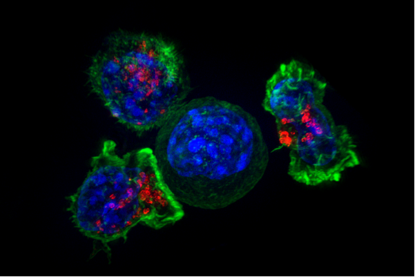 암세포(가운데 파란색)를 둘러싸고 공격하는 세포독성 T세포들./NIH