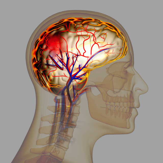 뇌졸중은 갑자기 마비·어지럼증 등의 증상이 나타난다. /클립아트코리아 제공