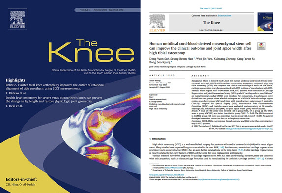 바른세상병원 관절클리닉 연구팀의 논문이 SCI(E) 국제학술지 ‘The Knee ’에 게재됐다.
